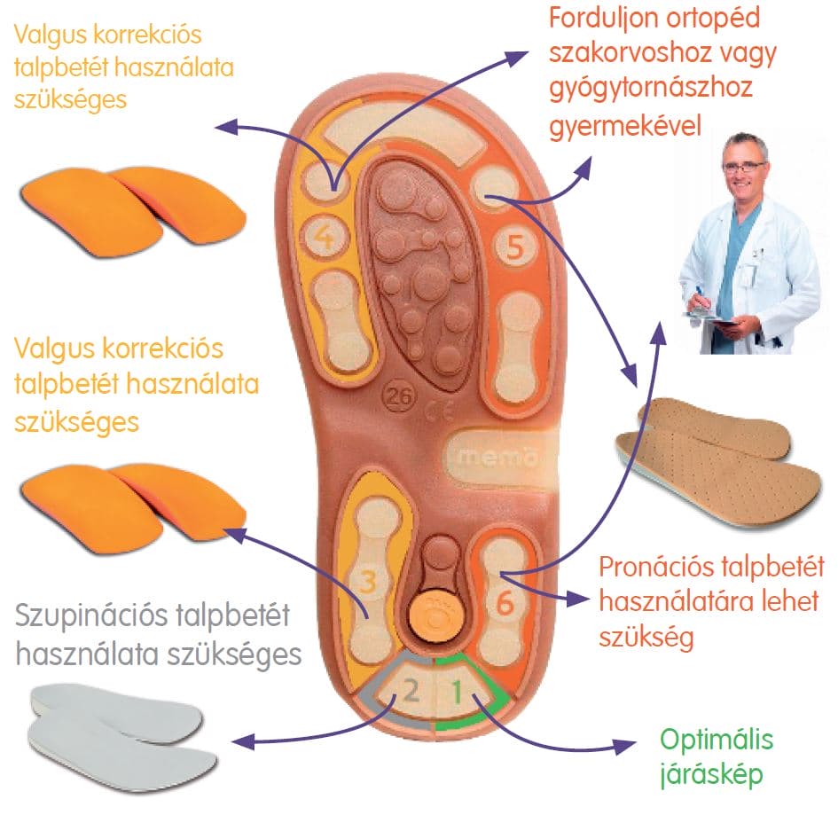 Diagnosztikai talp segít a betét kiválasztásában